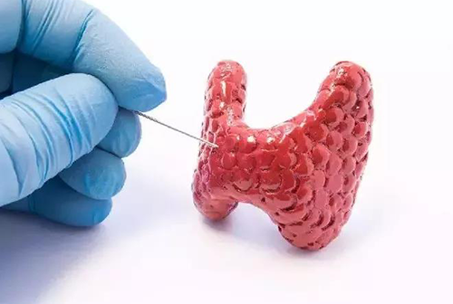 甲状腺疾病，包括甲状腺功能减退和甲状腺功能亢进，自古以来就是反复被医学研究人员研究的疾病